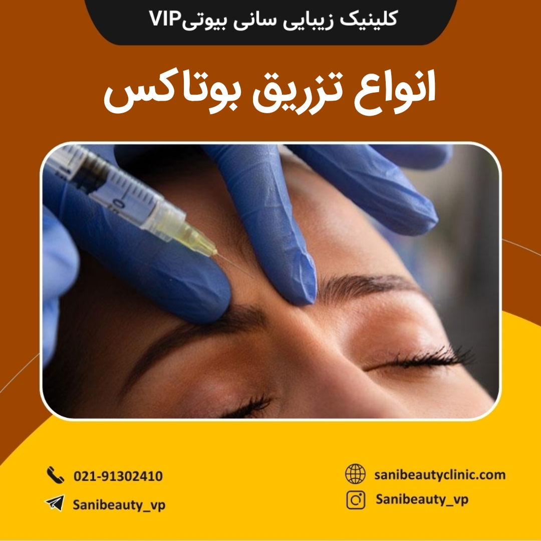 انواع تزریق بوتاکس