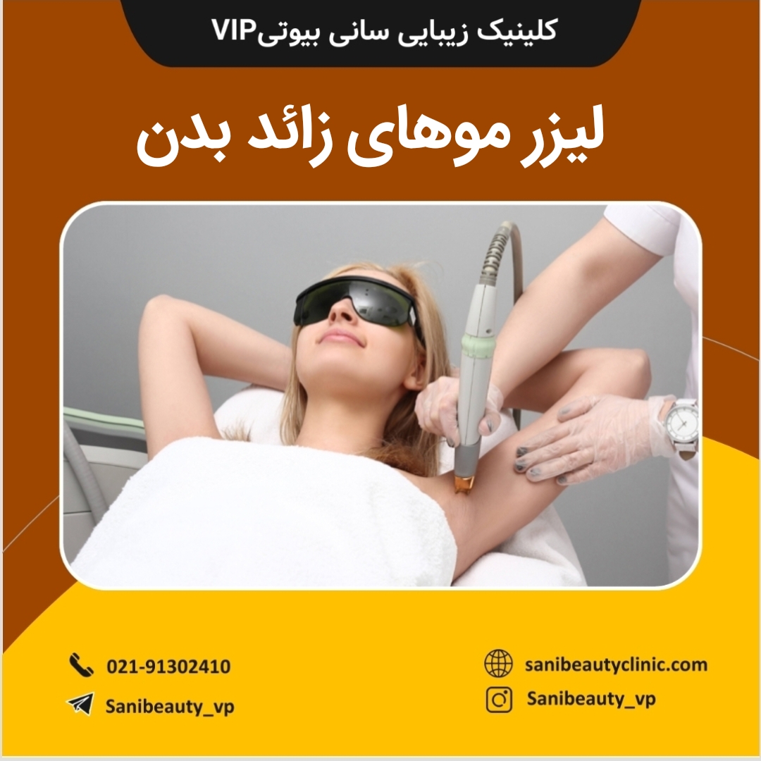 لیزر موهای زائد بدن